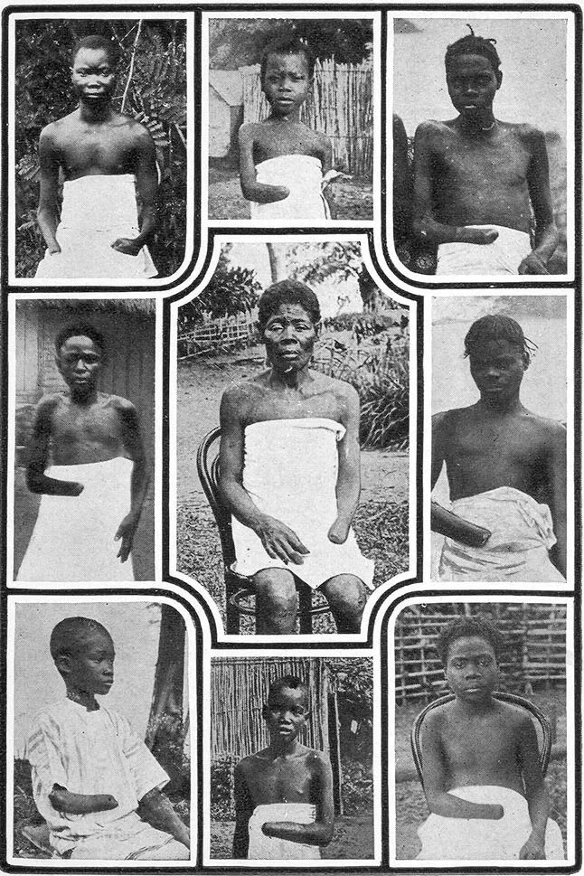 Congolese victims of King Leopold II's rubber regime, c.1904 Congolese victims of King Leopold II's rubber regime, c.1904